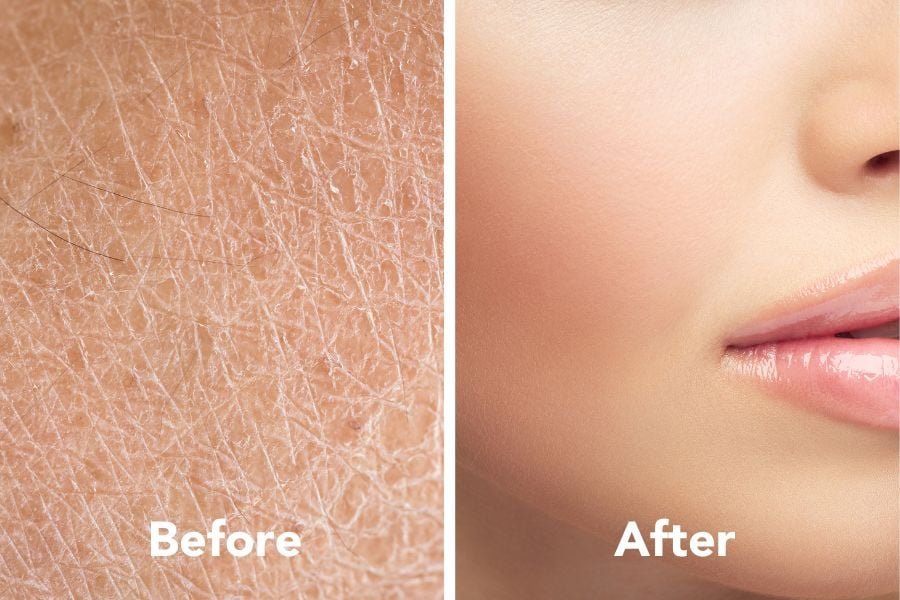 'Before and after comparison of dry and smooth skin.'